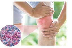 肠道菌群失调引发骨关节炎的机制研究