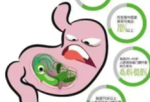 专家建议根除幽门螺杆菌以降低胃癌风险