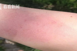 风筝线伤人事件频发为何禁放规定难阻放飞行为