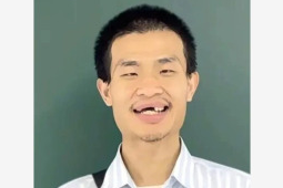 韦东奕牙齿引关注医生给出专业建议