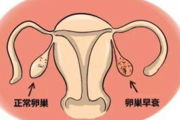 促排卵会导致卵巢早衰吗一次取几个卵泡最合适听专家科普