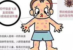 夏季战痘关键：保持皮肤正常呼吸