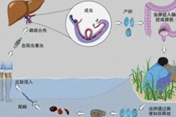 男子湖里游泳后出现血尿竟是虫子作祟预防方法速看