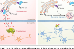瓯江实验室揭秘预防阿尔茨海默病最佳方法在于科学饮食