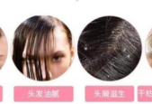 频繁洗头会导致脱发是真是假