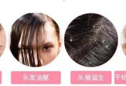 频繁洗头会导致脱发是真是假