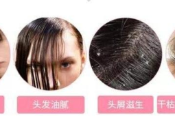 频繁洗头会导致脱发是真是假