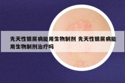 国产生物制剂为中重度斑块状银屑病患者提供新选择