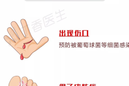 酒精是唯一彻底消毒伤口的方法吗
