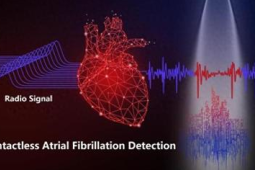 中国团队研发非接触式房颤检测系统助力心律失常早发现早干预