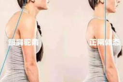 这样练彻底告别圆肩驼背
