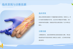 职业性腕管综合征预防方法专家详解