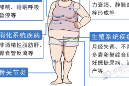 个不知不觉患上糖尿病的习惯很多人每天都在重复