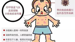 夏季战痘关键：保持皮肤正常呼吸
