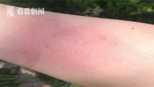 风筝线伤人事件频发为何禁放规定难阻放飞行为 第1张 风筝线伤人事件频发为何禁放规定难阻放飞行为 第1张