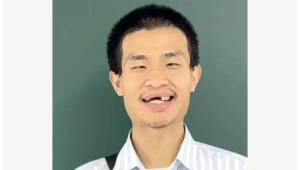 韦东奕牙齿引关注医生给出专业建议