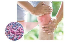 肠道菌群失调引发骨关节炎的机制研究 第1张 肠道菌群失调引发骨关节炎的机制研究 第1张