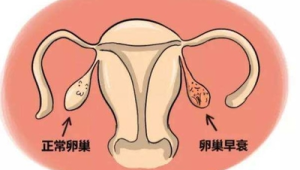 促排卵会导致卵巢早衰吗一次取几个卵泡最合适听专家科普  第1张
