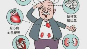 老年人越瘦越不易患心脑血管疾病吗 第1张 老年人越瘦越不易患心脑血管疾病吗 第1张