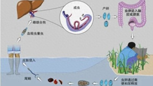 男子湖里游泳后出现血尿竟是虫子作祟预防方法速看 第1张 男子湖里游泳后出现血尿竟是虫子作祟预防方法速看 第1张