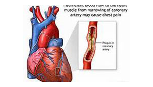 中美专家联手揭示心肌梗死治疗生物钟机制 第1张 中美专家联手揭示心肌梗死治疗生物钟机制 第1张