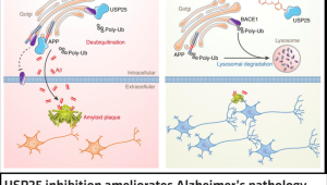 瓯江实验室揭秘预防阿尔茨海默病最佳方法在于科学饮食 第1张 瓯江实验室揭秘预防阿尔茨海默病最佳方法在于科学饮食 第1张