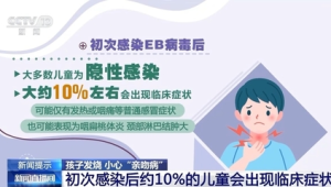 当心亲吻病别对孩子又亲又抱 第1张 当心亲吻病别对孩子又亲又抱 第1张