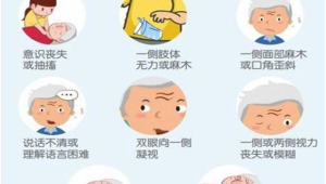中风年轻化趋势早发现这些症状能救命 第1张 中风年轻化趋势早发现这些症状能救命 第1张