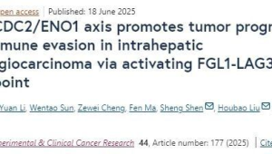 中国专家团队突破胆管癌分子诊断技术填补国际空白 第1张 中国专家团队突破胆管癌分子诊断技术填补国际空白 第1张