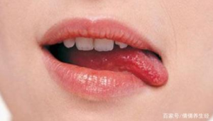 嘴唇干裂起皮可能不是缺水惹的祸 第1张 嘴唇干裂起皮可能不是缺水惹的祸 第1张