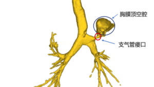 上海多学科专家运用三维重建技术成功救治复杂综合征型狭颅症患儿 第1张 上海多学科专家运用三维重建技术成功救治复杂综合征型狭颅症患儿 第1张