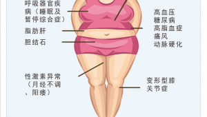 肥胖危害女性健康更甚 第1张 肥胖危害女性健康更甚 第1张