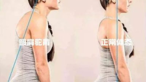 这样练彻底告别圆肩驼背 第1张 这样练彻底告别圆肩驼背 第1张