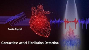 中国团队研发非接触式房颤检测系统助力心律失常早发现早干预 第1张 中国团队研发非接触式房颤检测系统助力心律失常早发现早干预 第1张
