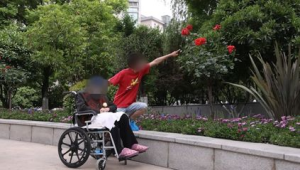 亚洲首例异种肾移植患者术后体征平稳超天 第1张 亚洲首例异种肾移植患者术后体征平稳超天 第1张